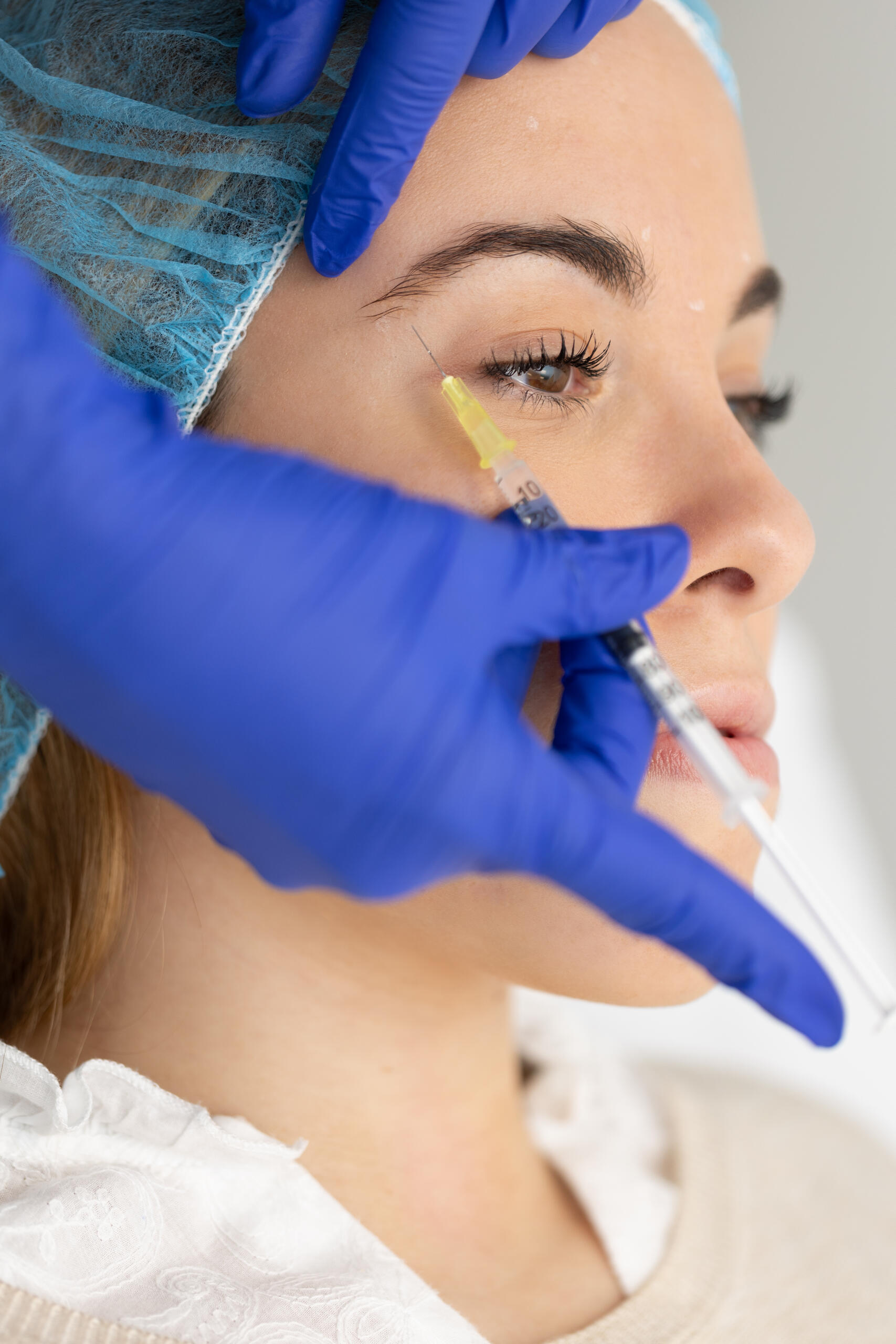 Mesoterapia periocular
