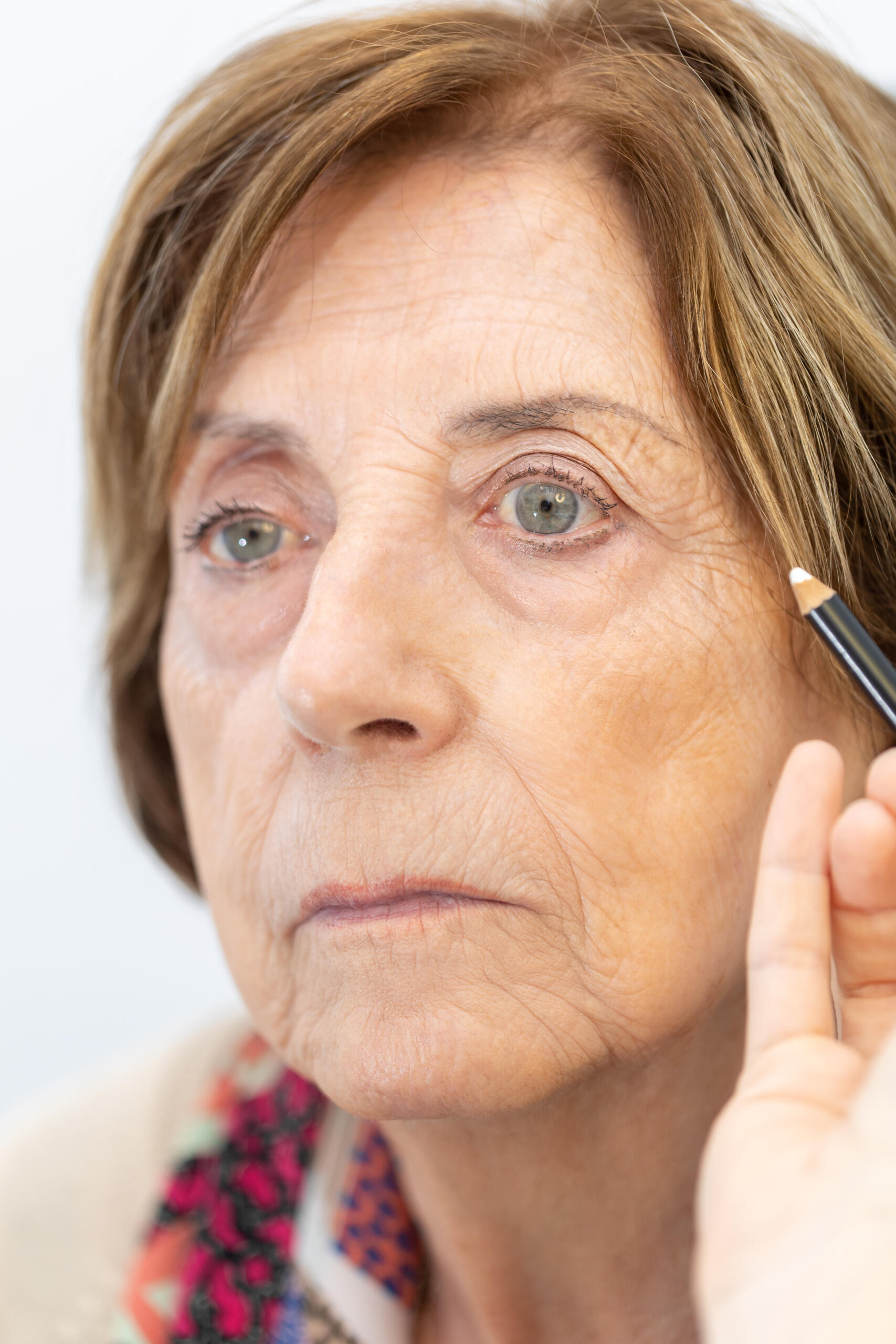Cirugía estética periocular
